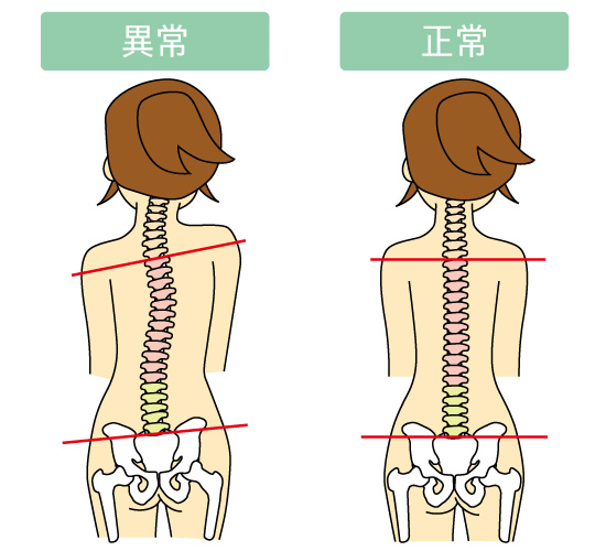 真後ろから見た背骨の状態 真後ろから見た背骨の状態