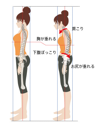 骨盤が歪むと背骨も歪む 骨盤が歪むと背骨も歪む