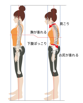 骨盤が歪むと背骨も歪む